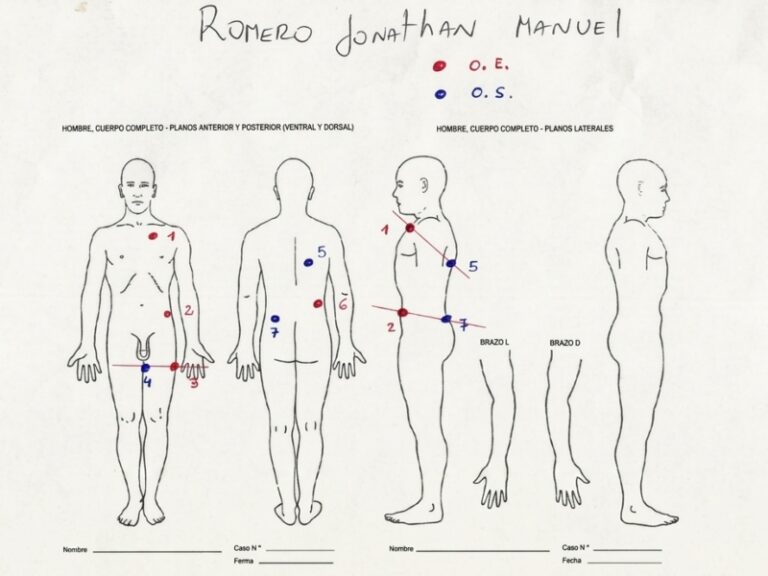 Ilustración forense genérica representando un informe de autopsia